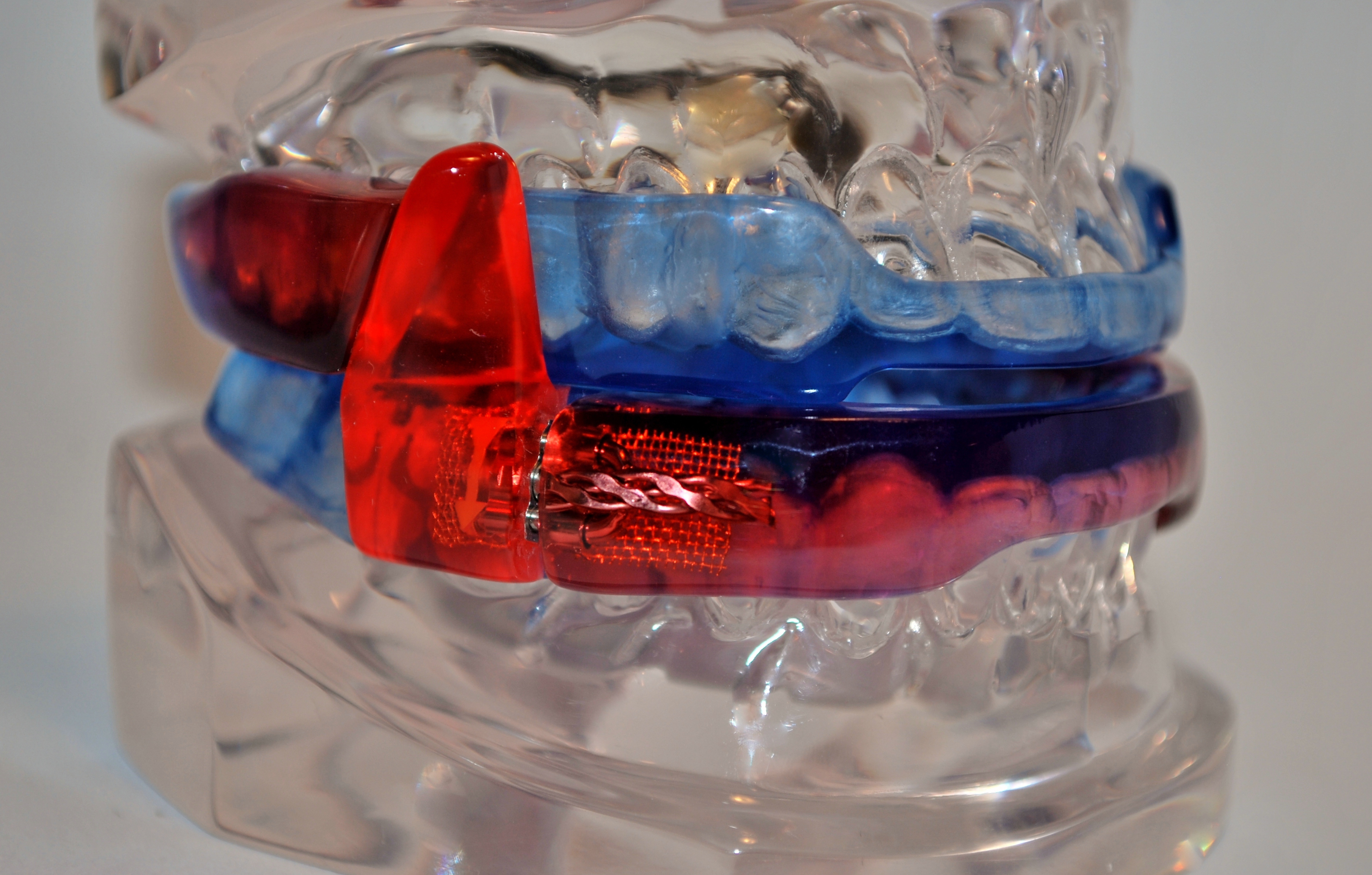 Respire Medical’s Oral Appliances for the Treatment of Snoring and